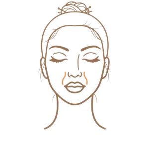 Front face illustration highlighting nasolabial folds running from nose to mouth
