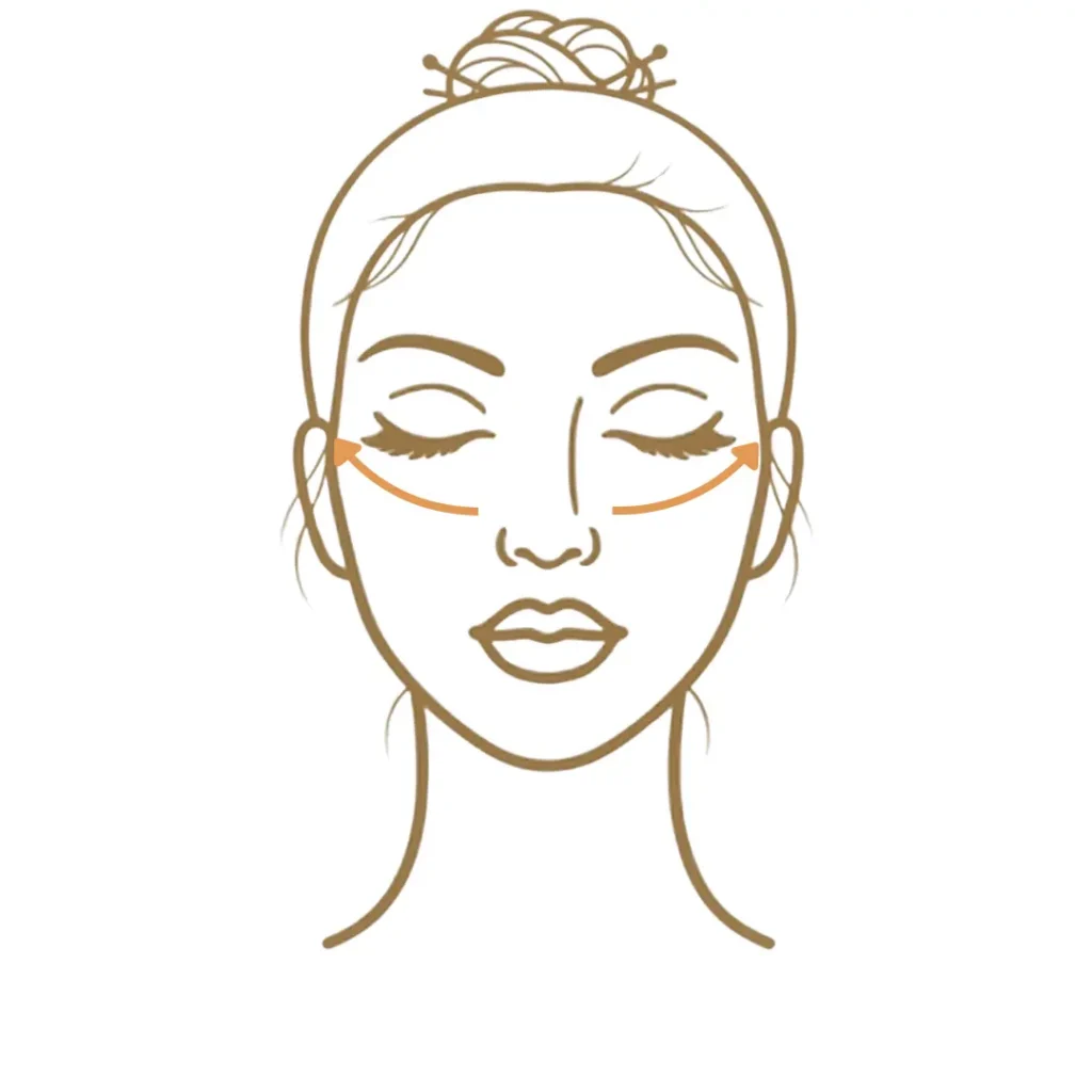 Face illustration showing under eye laxity with lines beneath the eyes