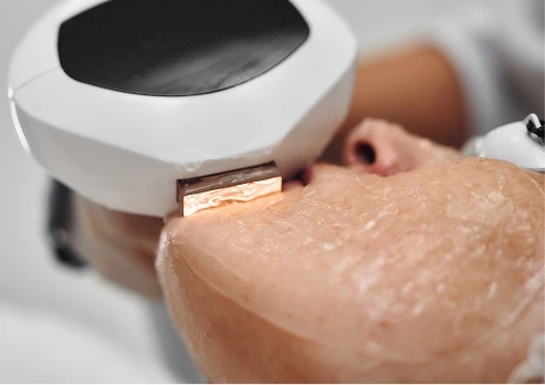 Close-up of a professional skin-tightening device being applied to a patient's jawline to support firmness and structural resilience.
