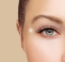 Close-up of a Luxe Lips patient’s eye area following an eye rejuvenation treatment.