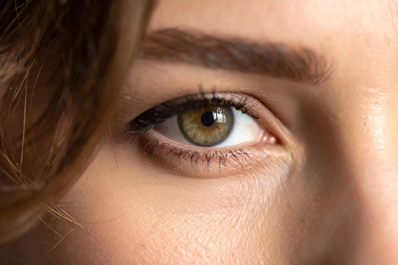 Practitioner marking the eye area with a directional arrow to plan a fox eye thread lift