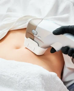 Laser handpiece applied to a woman's abdomen for Fotona body sculpting in Melbourne