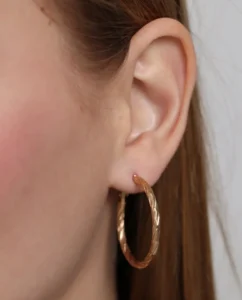 Close-up of a woman's ear and earlobe for earlobe rejuvenation in Melbourne