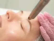 Fotona 5d laser treatment