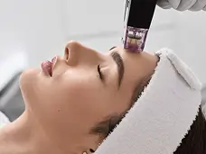 RF Microneedling (Morpheus8)