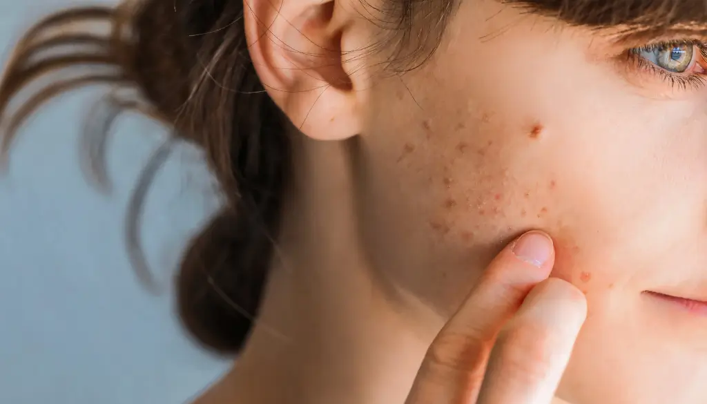 Texture Support + Early Scar Change (Adjunctive Plan)