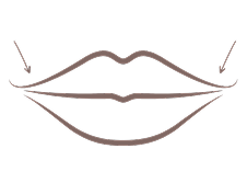 Lip illustration showing targeted enhancement areas for customised lip treatment in Melbourne