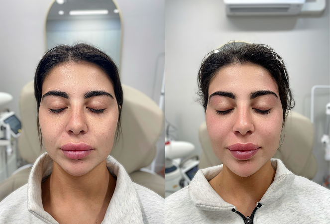 BeforeAndAfterSetC-1