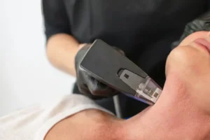 Clinician performs Morpheus8 lower face treatment using a handheld device along the jawline and chin area.