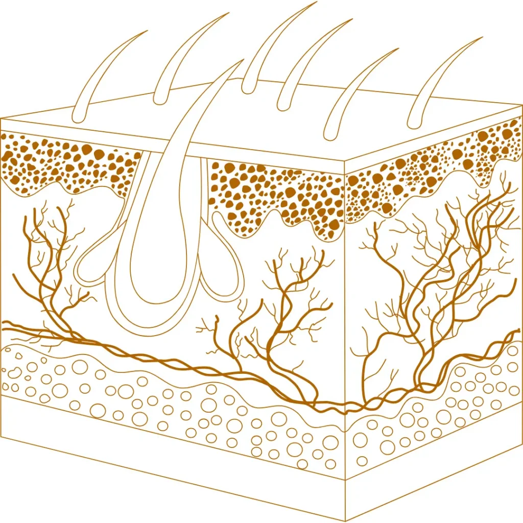 fotona laser collagen stimulation skin layers diagram