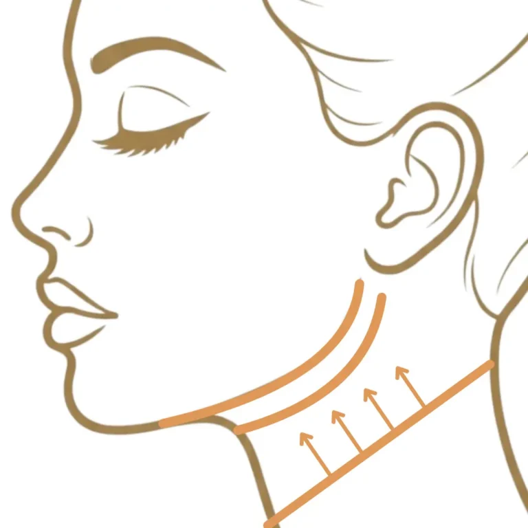 Illustration showing soft jawline definition along the lower face