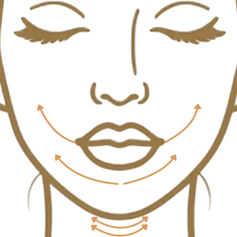 Illustration showing lower face heaviness around the mouth and jaw