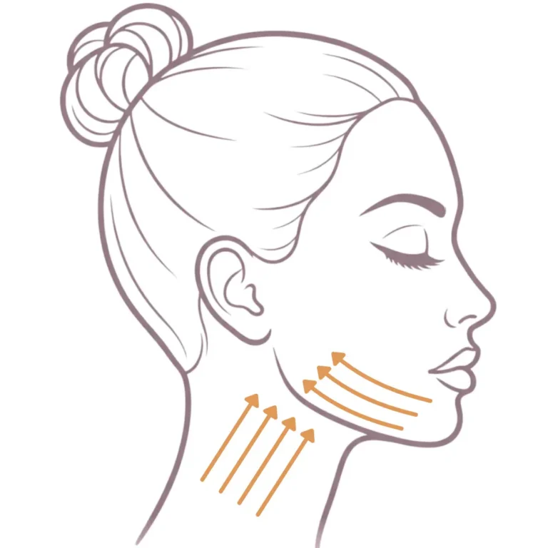 Illustration showing reduced support and skin laxity in the neck area
