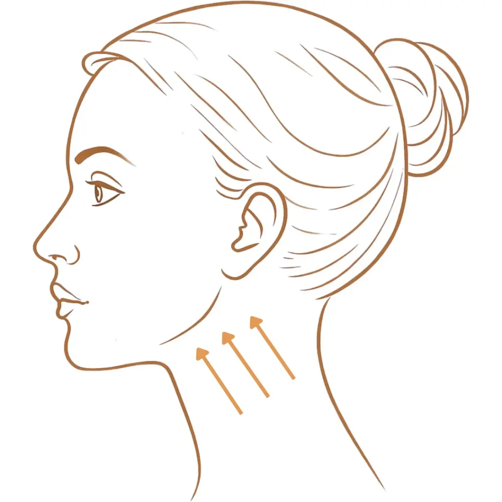 Side profile illustration showing neck skin laxity with lifting arrows along the jaw and neck
