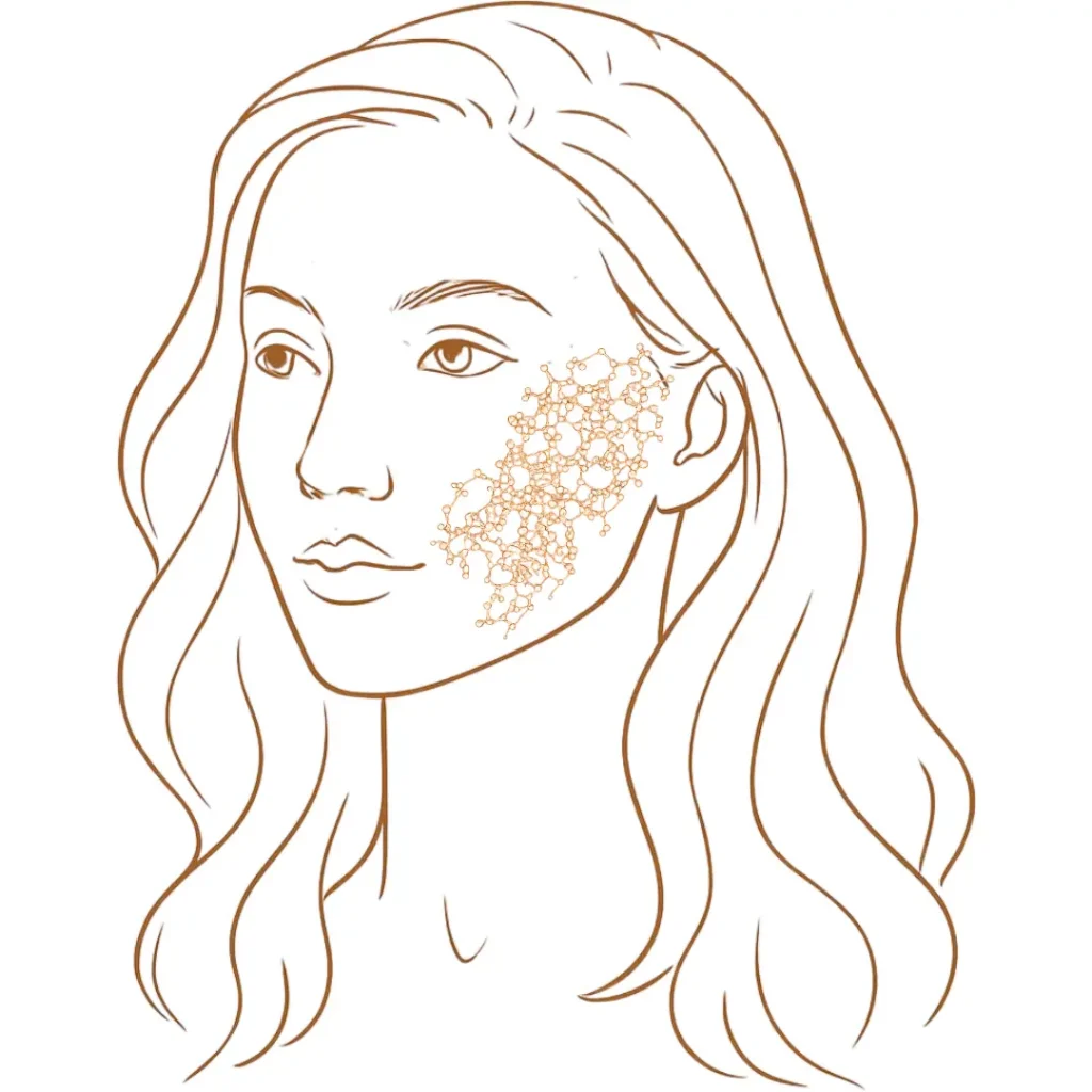 Facial illustration highlighting reduced skin firmness with collagen matrix in the cheek area