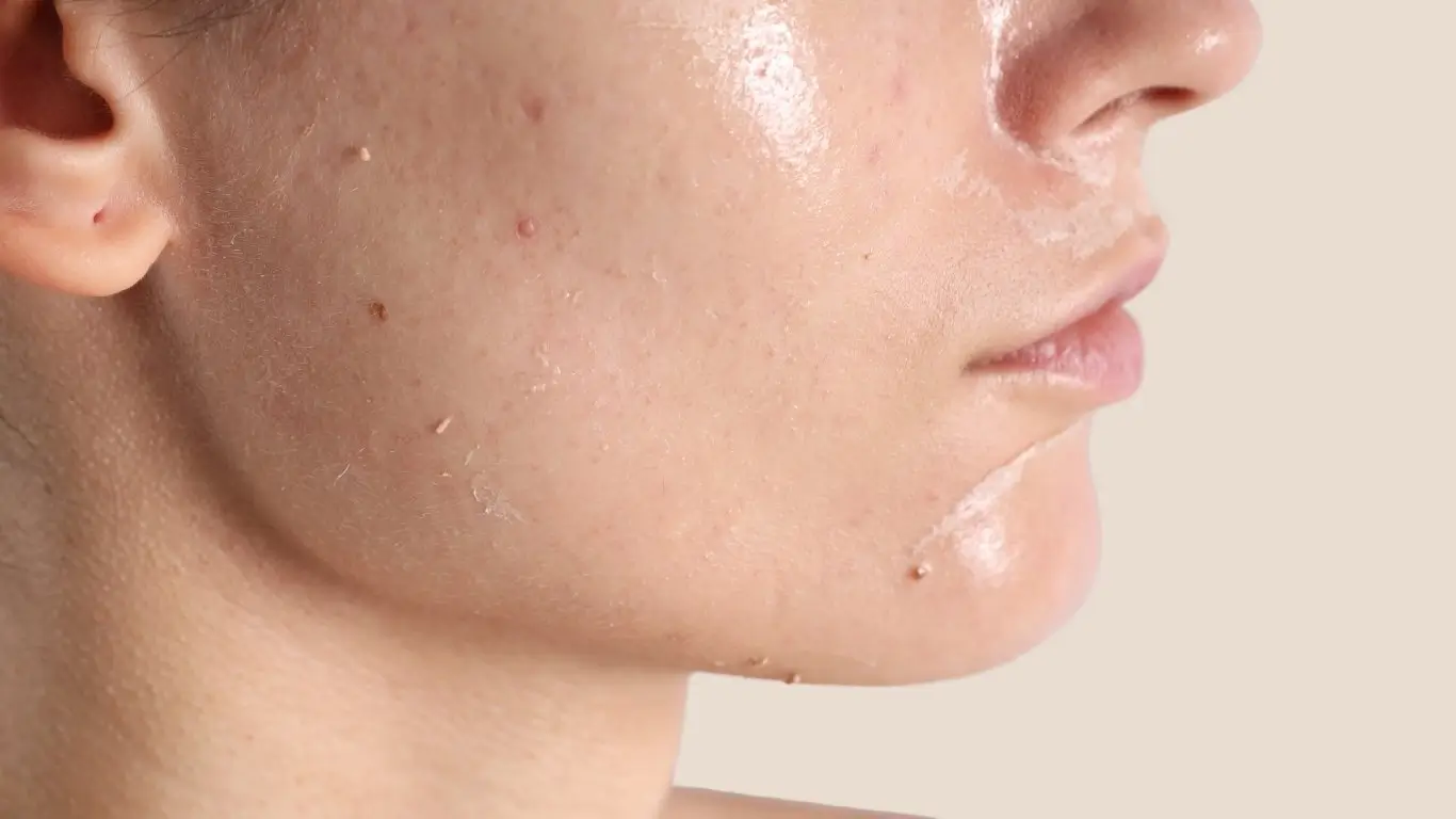 Skin rejuvenation treatments