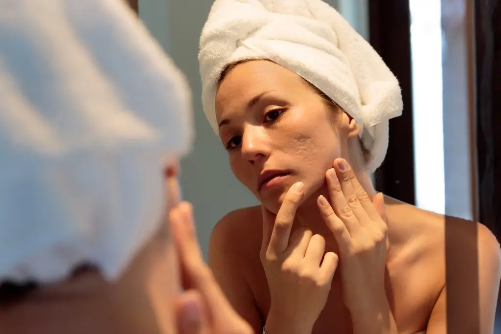 Close-up of a woman examining the texture of her skin in a mirror, reflecting the personal experience of living with acne scars.