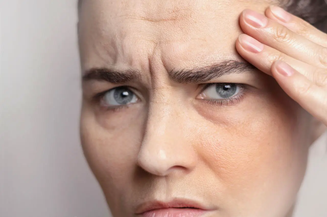 A close-up of a woman frowning, showing visible fine lines and forehead wrinkles emphasized by dry-looking skin.