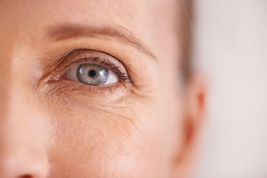 Close-up of eye area showing fine lines and wrinkles under eyes, highlighting common signs of ageing such as crow’s feet and skin texture changes