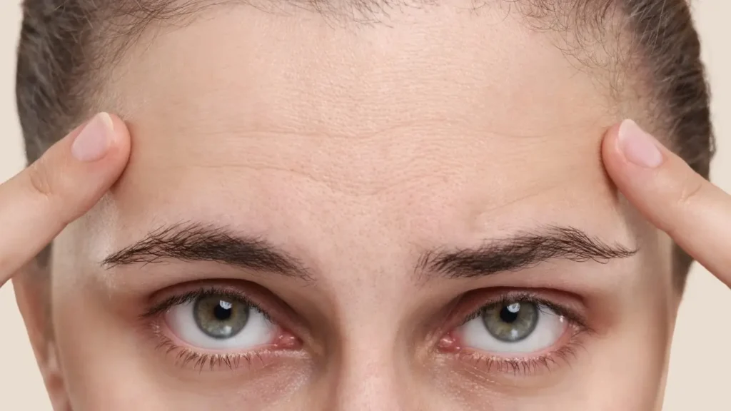 Fine lines and wrinkles melbourne