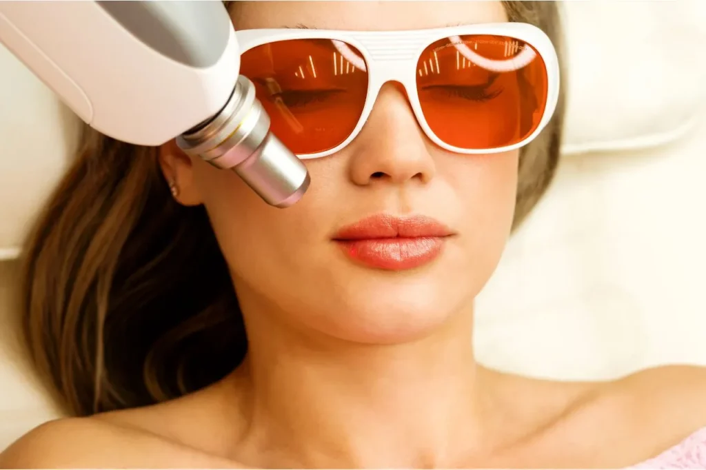 Woman receiving a Fotona LipLase laser treatment to the lower face, wearing protective eyewear