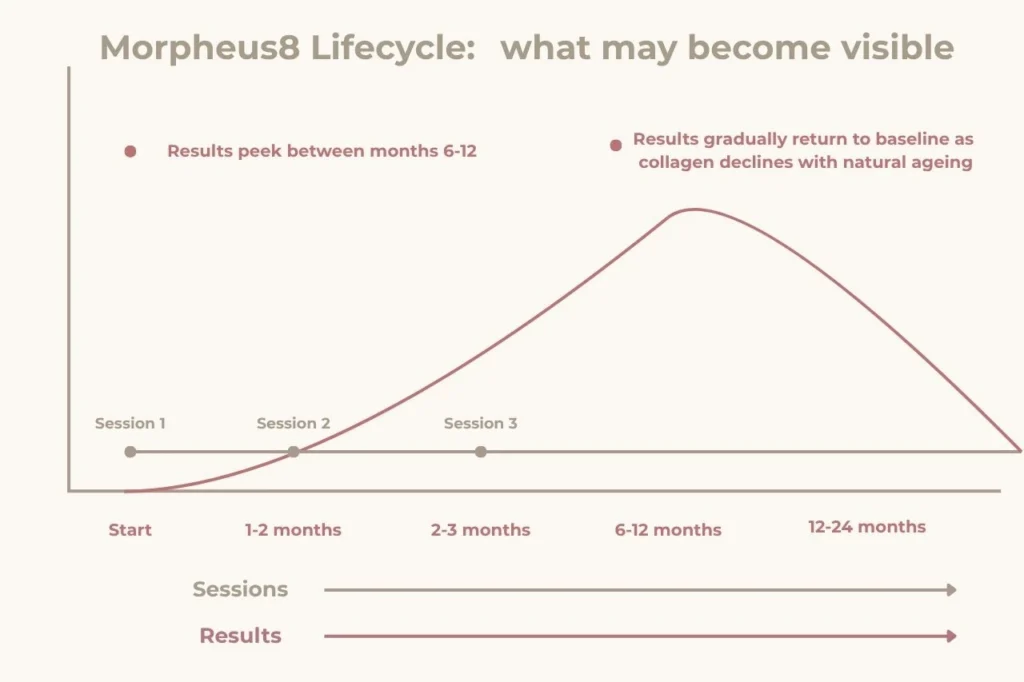 Morpheus8 Melbourne treatment timeline showing typical protocol of 3 sessions spaced 4 to 6 weeks apart.