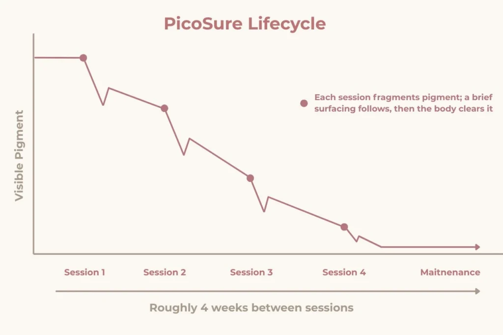 PicoSure laser treatment progression showing typical protocol of 4 to 6 sessions spaced 4 weeks apart