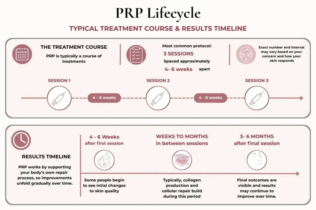 PRP treatment timeline showing a typical course of three sessions spaced four to six weeks apart, with change appearing gradually over the weeks and months after each session.