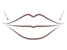 Lip illustration showing targeted enhancement areas for customised lip treatment in Melbourne