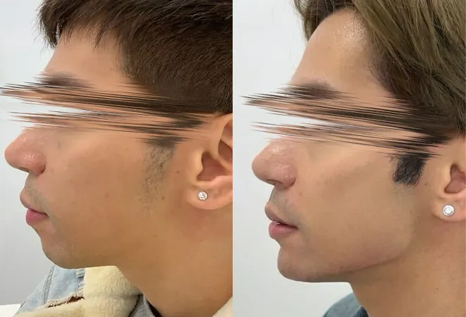 BeforeAndAfterNewSetA-1