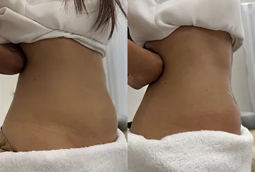 Set c
