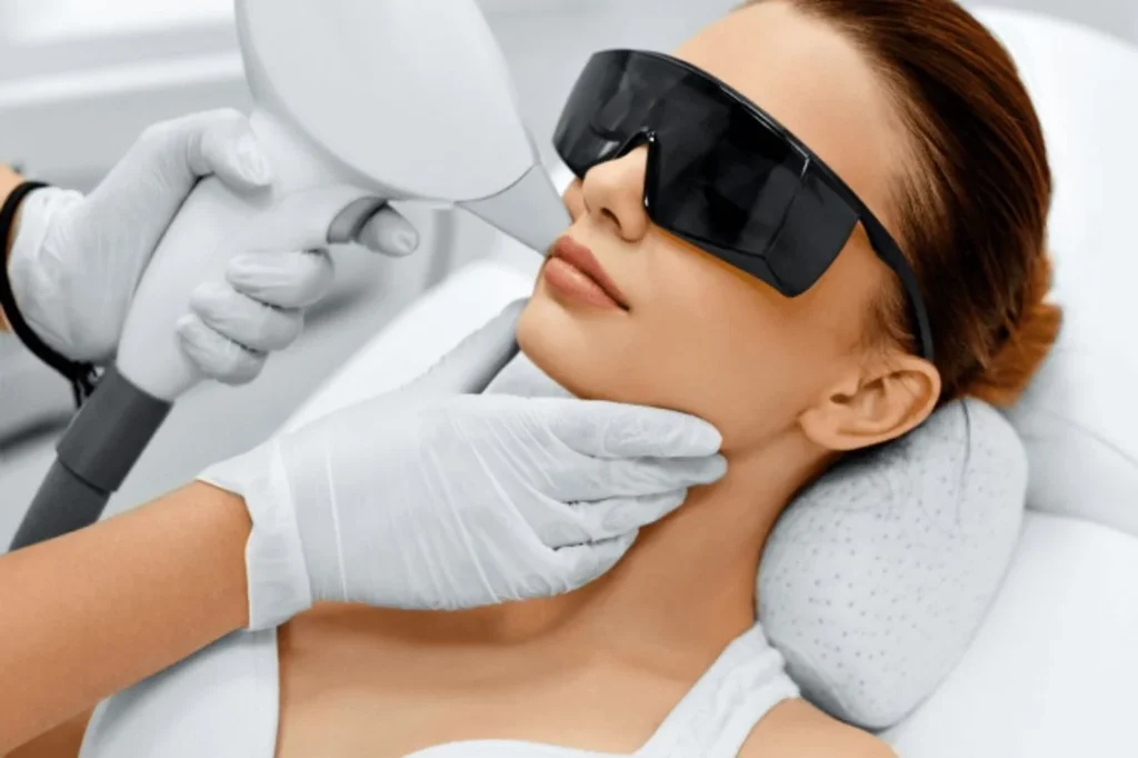 Woman receiving Lumecca IPL treatment